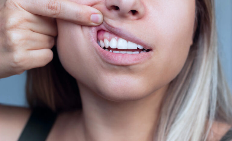 Periodontologia Toruń periodontologia toruń